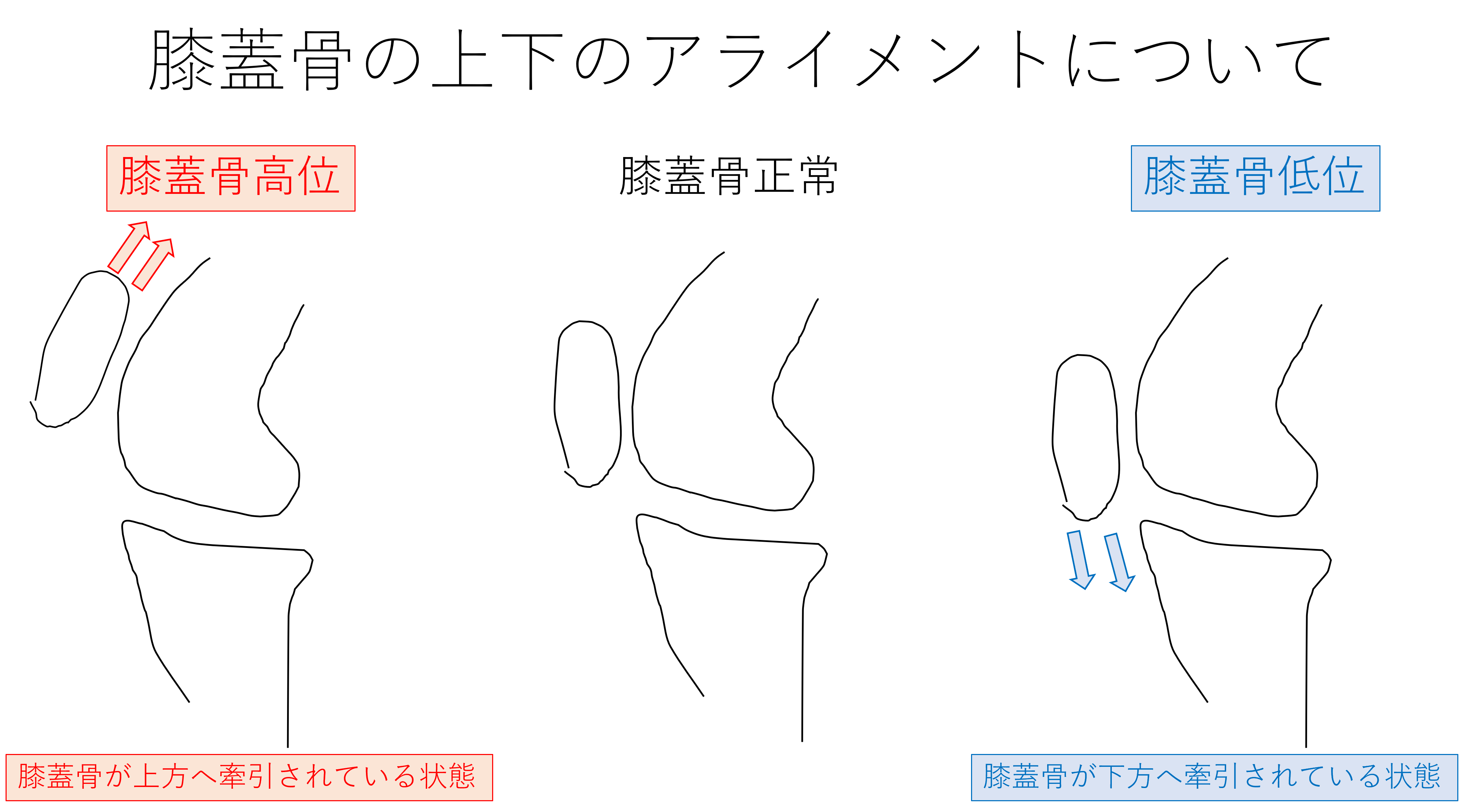 特定のエクササイズを早すぎると危険